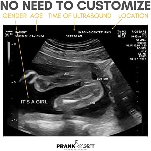 Pranknant Hamis Ultrahang Képek Tréfa | 2D Szalag, 3 Photos | Terhességi Ultrahang Fotók | Tréfa Terhességi Ultrahang (Ikrek)